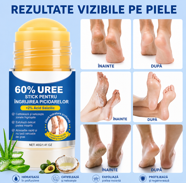 Cremă pentru călcâie